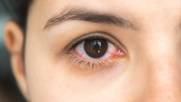 Не только усталость: какие болезни скрываются за покраснением глаз
