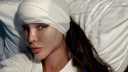 «Самочувствие — терпимо»: жена звездного хирурга Хайдарова сделала пластику