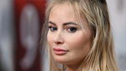 Один глаз больше другого: Дана Борисова показала лицо после пластики