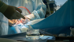 В легком 17-летней москвички обнаружили гигантскую кисту с червями