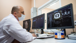 Не просто усталость: как понять, что щитовидка дала сбой