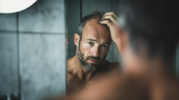 До седин: как и откуда пересаживают волосы на голову