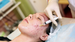 Красота или жизнь? Почему беременным нельзя использовать средства с ретиноидами