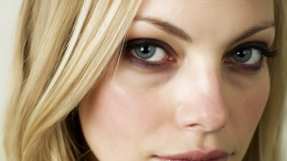 Тяжелый взгляд: о чем говорят «мешки» под глазами