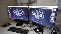 Жизнь без боли: как победить мигрень