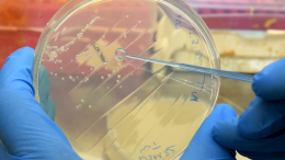 Ученые нашли бактерии, убившие армию Наполеона при отступлении из России