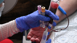 В России начали диагностировать депрессию и шизофрению по анализу крови