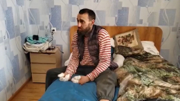 Спасенный на Урале турист получил ожоги рук, отбиваясь от волков горящими поленьями