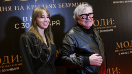 Последствия развода: Полина Диброва показала покрытое синяками лицо