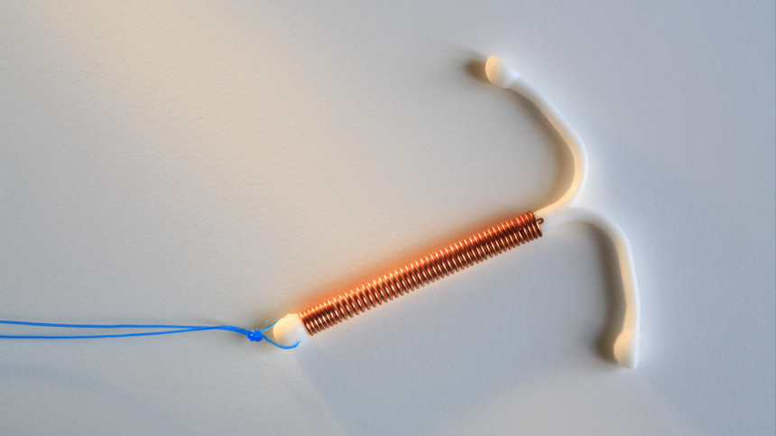 В Бразилии младенец родился с внутриматочной спиралью в рука