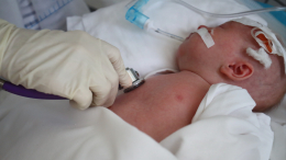 Ученые обнаружили новый тип диабета у новорожденных детей