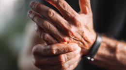 «Помолодевшее» заболевание: россияне в возрасте 40 лет все чаще страдают от артрита