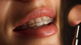 Во всем виноваты зубы: как неправильный прикус влияет на организм