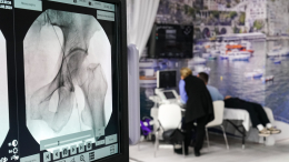 Не только старики: почему все больше молодых людей страдают от болезней костей