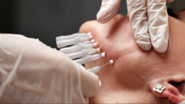 Инъекция с маркетплейса: как подпольная косметология уродует женщин