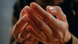 Зуд в теле — предвестник судьбы? К чему чешутся ладони, нос и ухо