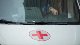 Жительница Липецкой области наступила на котенка и получила ожоги 30% тела