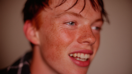 Губы, глаза, голова: почему у людей появляются тики