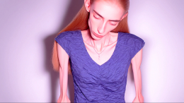 Сливочное масло, сырое мясо и гельминты: как модные диеты доводят до анорексии и смерти