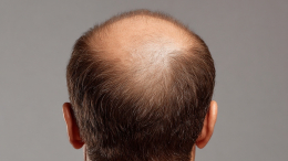 Приданое под угрозами: женщина подала в суд на мужа из-за лысины