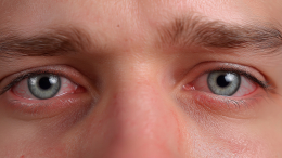 «Песок» и боль: офтальмолог объяснила опасность синдрома сухого глаза