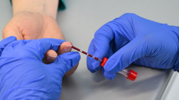 Россиян начнут бесплатно обследовать для определения рисков раннего старения