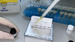 Заболевшие оспой обезьян в России в последнее время не выезжали за границу