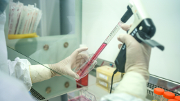 Чудеса, да и только: названы новые методы исцеления ран