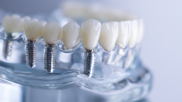 Стоматология на кухне: опасные товары для лечения зубов заполонили маркетплейсы