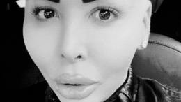 Умер «король губ», двойник Ким Кардашьян Джордан Парк