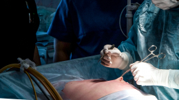 Чужая среди своих: канадка заговорила с русским акцентом после операции