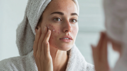 Физические барьеры и гормоны: как избавиться от привычки давить прыщи
