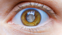 Жизнь в тумане: как катаракта меняет зрение и можно ли из-за нее ослепнуть