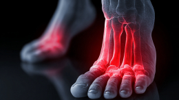 Вместо стройности — подагра: к чему могут привести популярные диеты