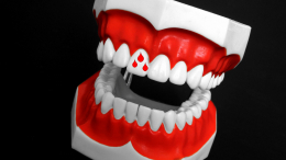 Кровоточат десна: какие проблемы полости рта являются симптомами рака кишечника