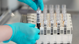 Рак желудка на самой ранней стадии можно будет выявить по анализу крови