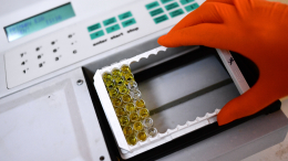 «Алиментарный путь»: энцефалитом можно заразиться не только через укус клеща