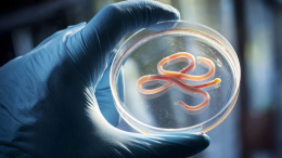 Живут внутри вас: как понять, что в организме есть глисты и другие паразиты — симптомы и лечение