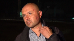 Отрезали бы пальцы? Корреспондента «Известий» избили за репортаж о красивых номерах