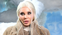 Поклонники встревожены странным поведением Самойловой после развода