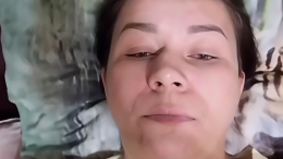 Новое лицо: блогер Иришка Чики-Пики сделала пластическую операцию