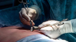 «Отек — нормально»: хирург о том, как правильно оценить пластическую операцию