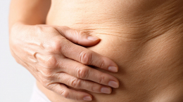 Хирург назвала способ избавиться от обвисшей кожи после похудения