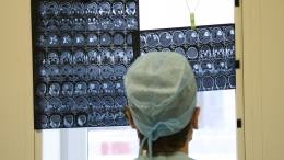 Неявный сигнал: раскрыт проявляющийся на несколько секунд симптом опухоли мозга