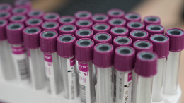 Сигналы в крови: какие показатели в анализах указывают на развитие рака